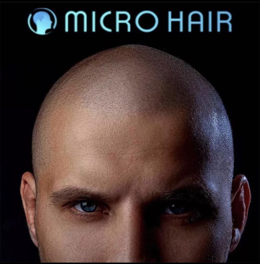 Boost Your Confidence With Scalp Micropigmentation Solutions in Manchester