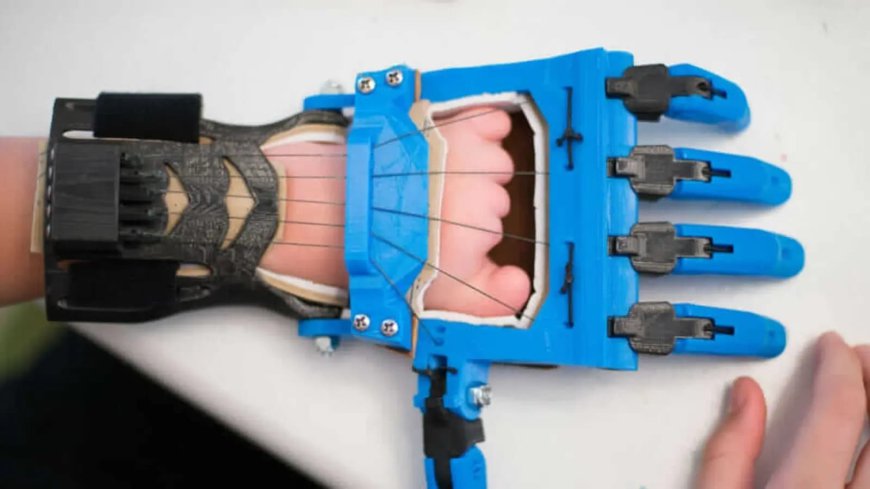 3D Printed Prosthetics Market Size, Share & Forecast Report 2024-2032