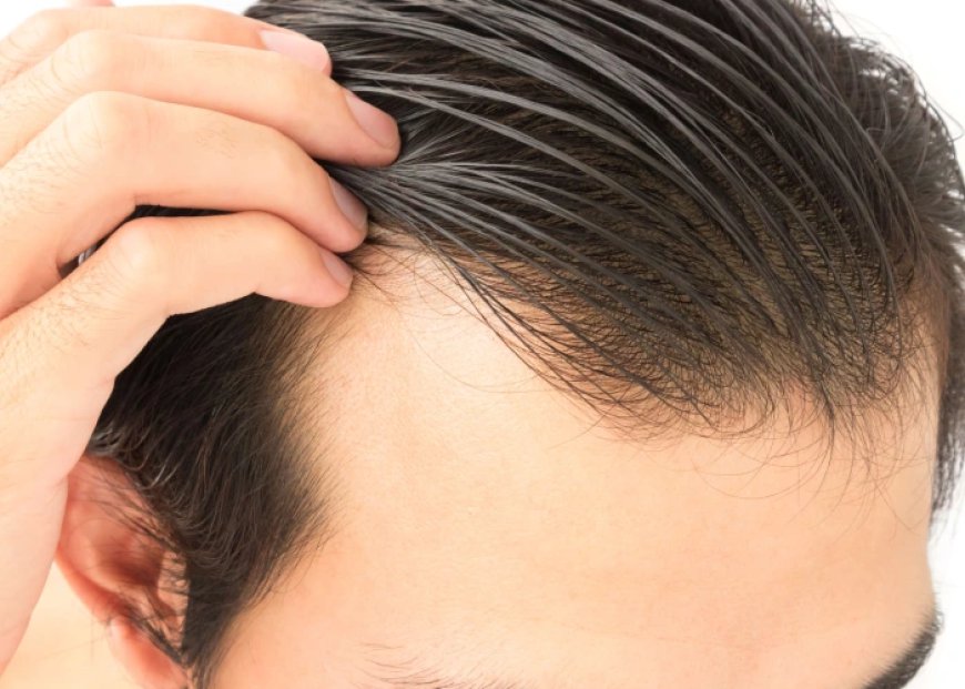 Dubai Hair Transplant: Key Considerations for a Successful Outcome