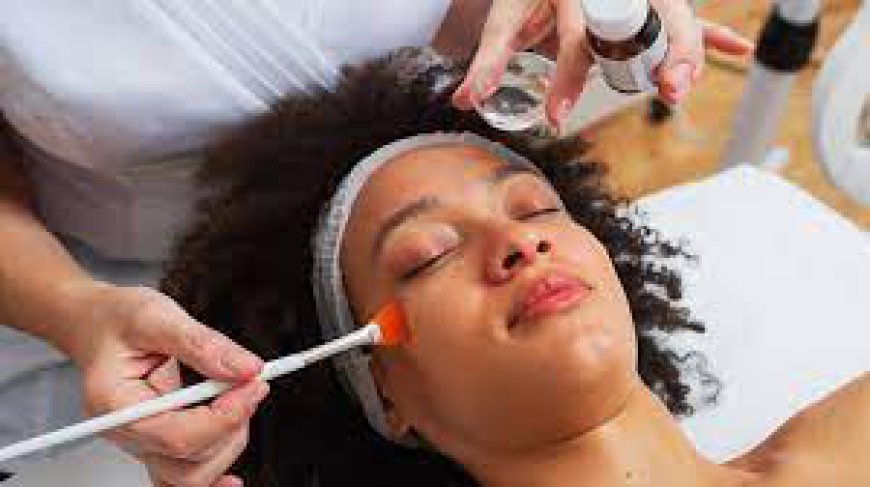 Understanding the Cost of Chemical Peels in Dubai