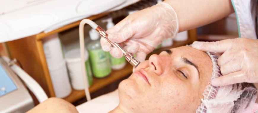 Laser Acne Treatment: Your Key to Clear Skin