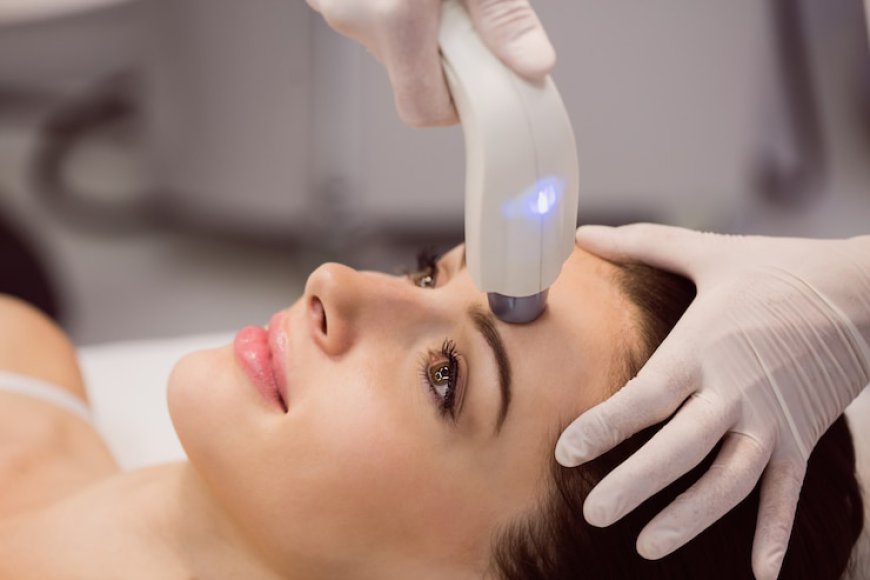 Revolutionize Your Skin with Laser Acne Treatment