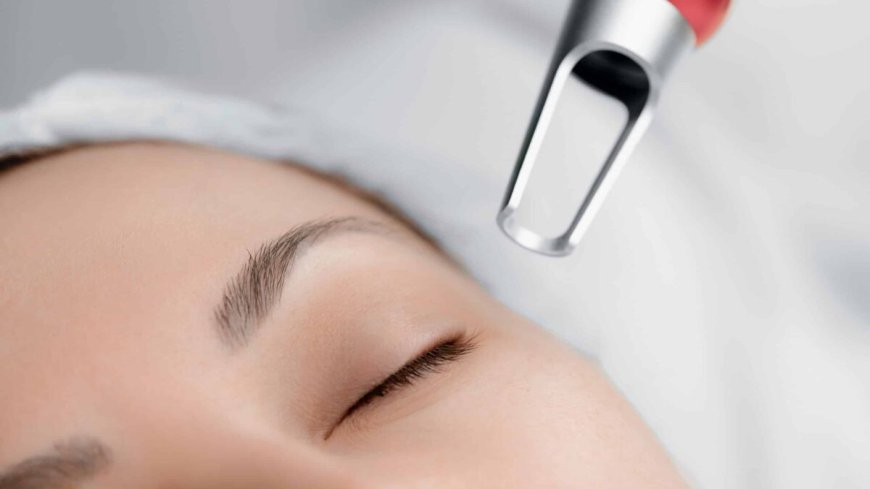 Laser Acne Treatment: Confidence Through Clarity