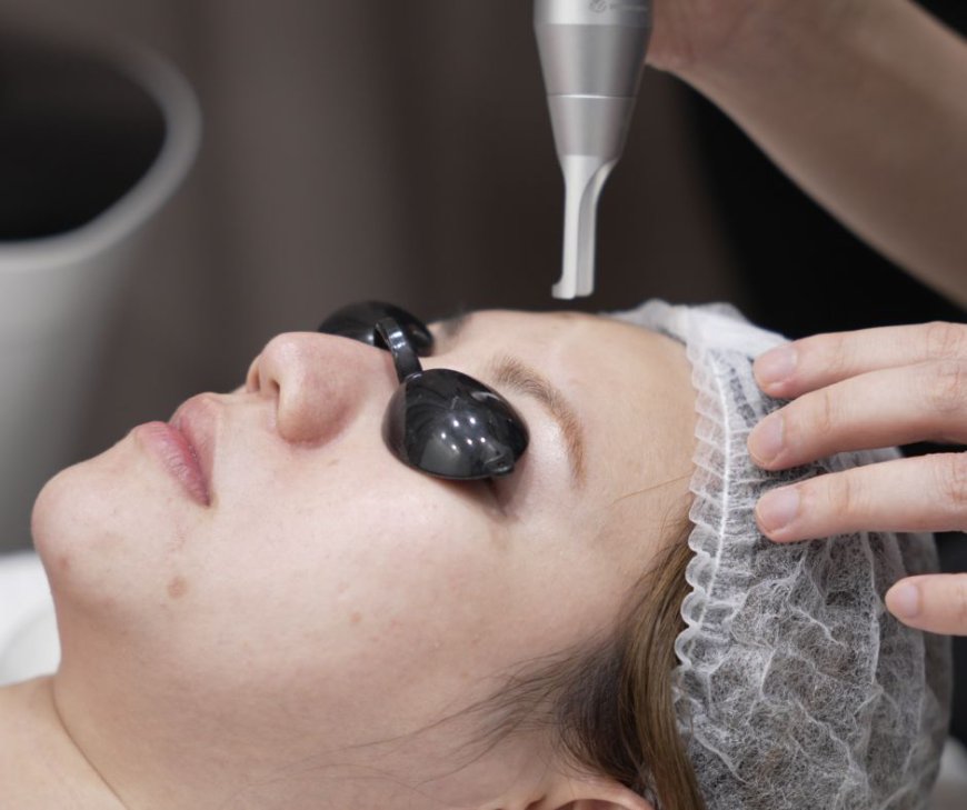 Solutions Shine with Confidence Post Laser Acne Treatment