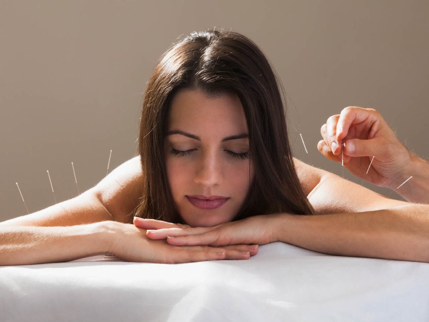 The Ultimate Guide To Cosmetic Acupuncture in San Diego For Glowing Skin