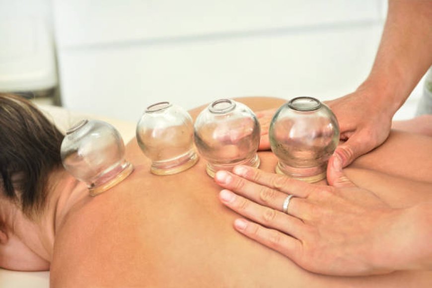 Boost Your Energy with Cupping in Riyadh