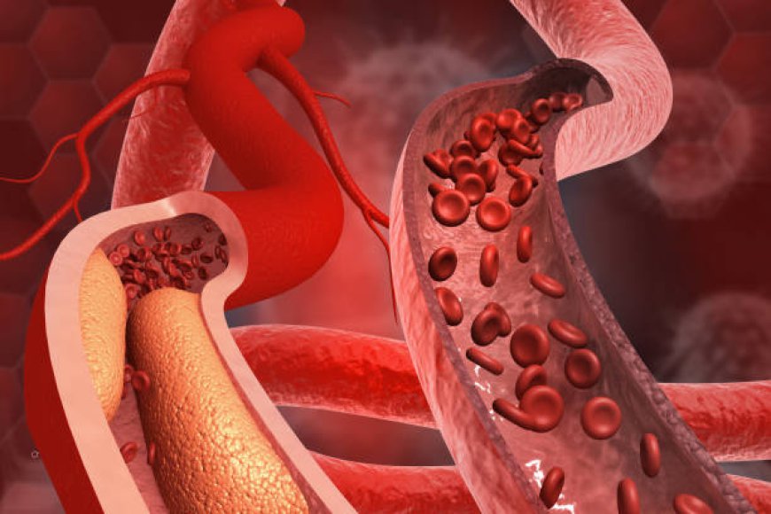 From Diagnosis to Recovery: Vascular Surgery Insights for Riyadh Residents