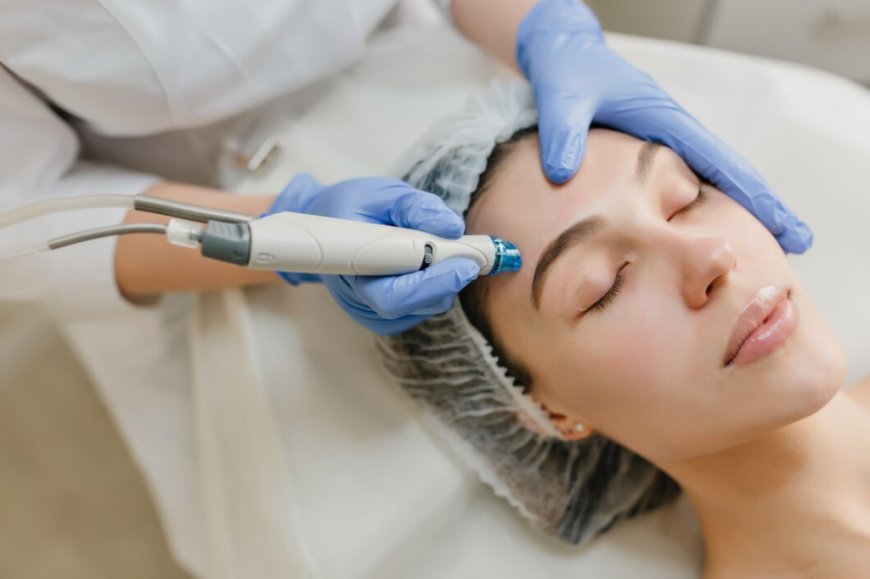 Awaken Your Skin with Microneedling Treatments