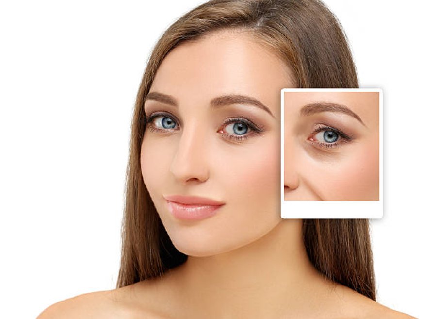 Elevate Your Appearance with the Best Eyelid Surgery Doctor in Riyadh