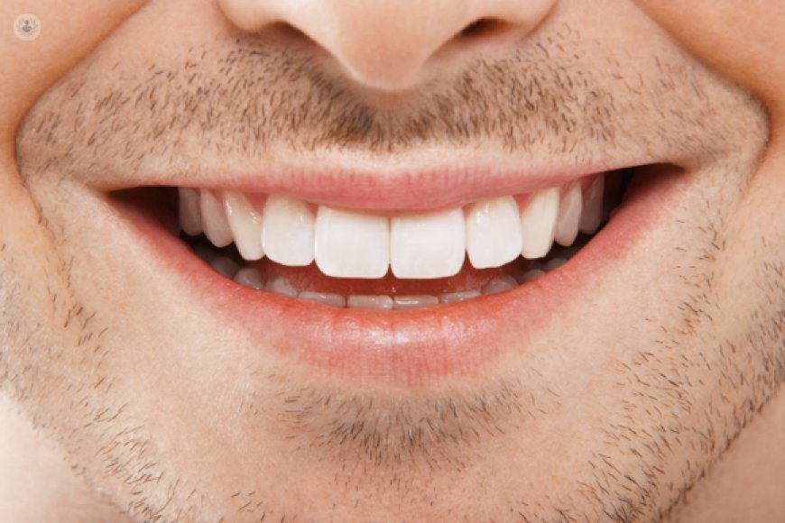 The Best Cosmetic Dentistry in Pakistan: Achieve Your Perfect Smile