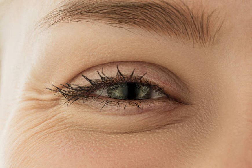 Achieve a Youthful Glow with Eye Bag Removal in Riyadh