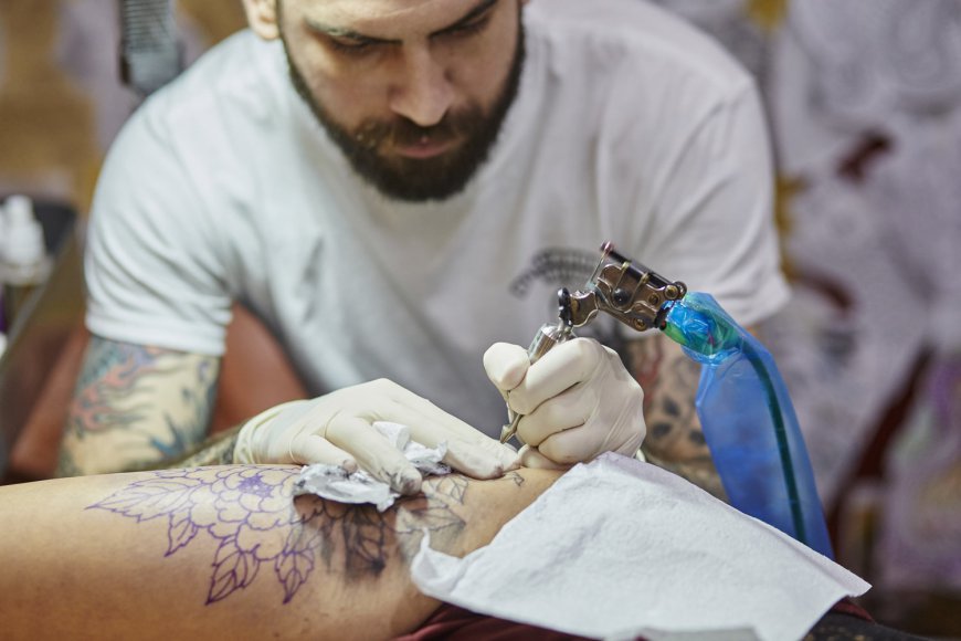 Laser Tattoo Removal: Say Goodbye to Inconvenient Ink