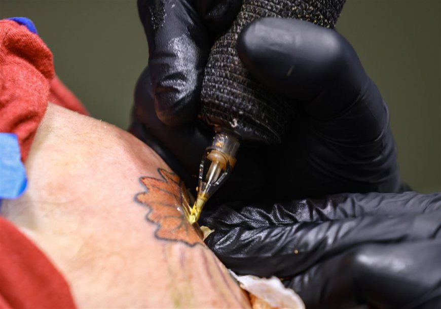 The Advantages of Laser Tattoo Removal for All