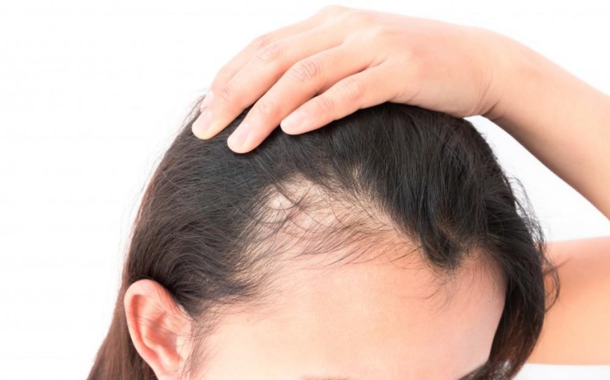 Finding the Best Hair Transplant Deal in Dubai