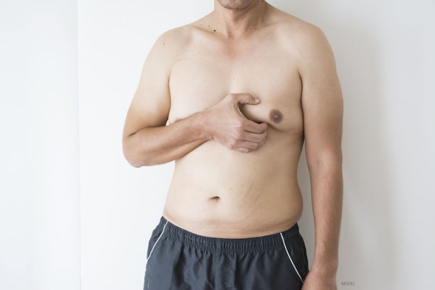 The Ultimate Guide to Gynecomastia Reduction Surgery in Dubai