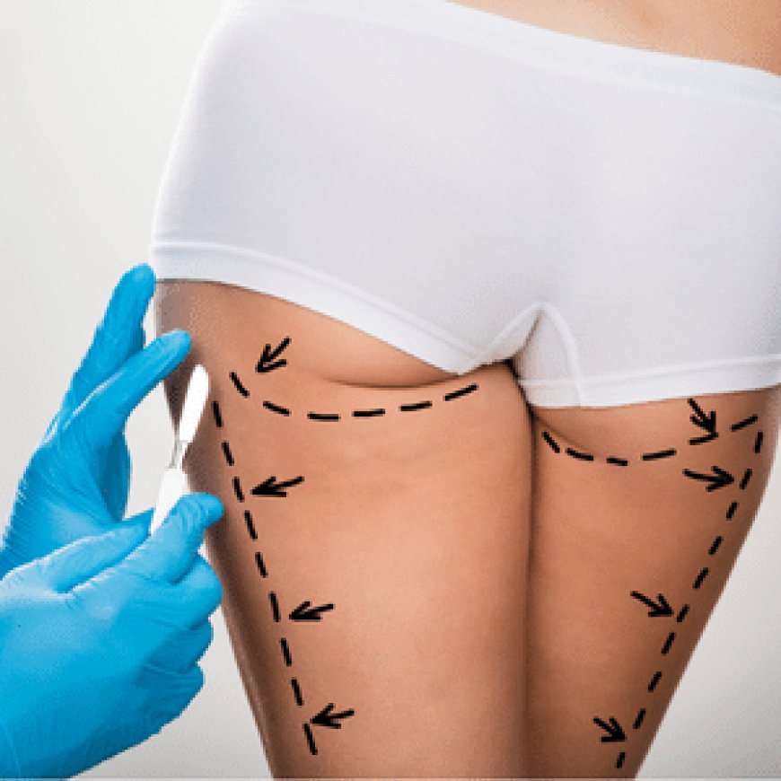 Cost Insights: What You Should Know About Liposuction Pricing in Riyadh