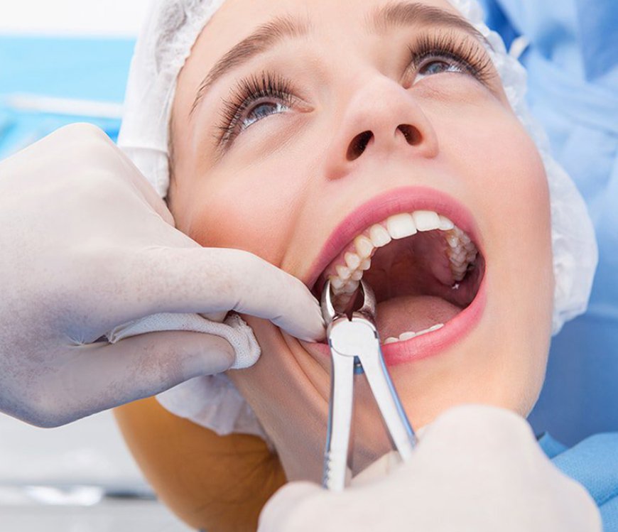 "What to Expect When You Visit a Top-Rated Dental Clinic in Riyadh"