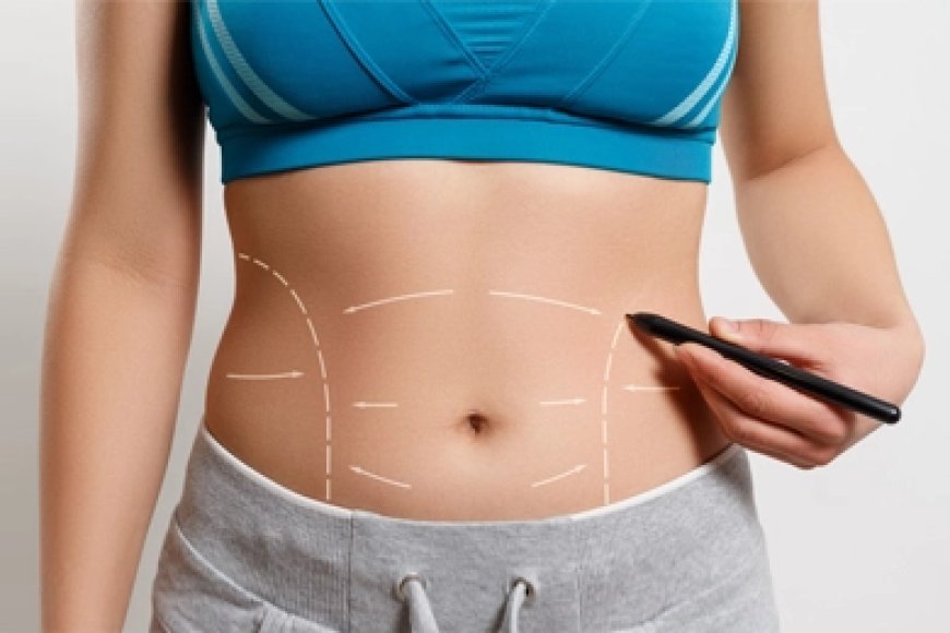 Tummy Tuck Dubai: The Secret to a Flatter Abdomen