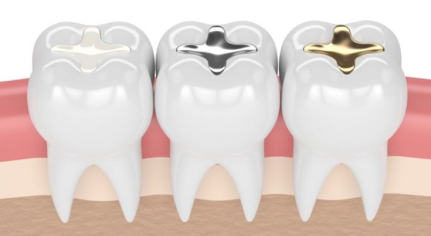 Exploring the Latest Technology at a Dental Clinic in Riyadh