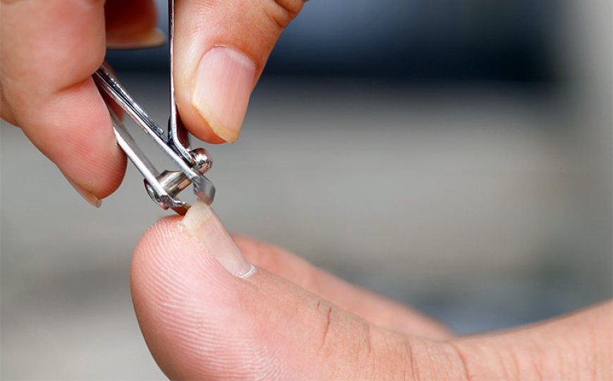 Why You Need Nail Scissors for Ingrown Toenails in Your Kit