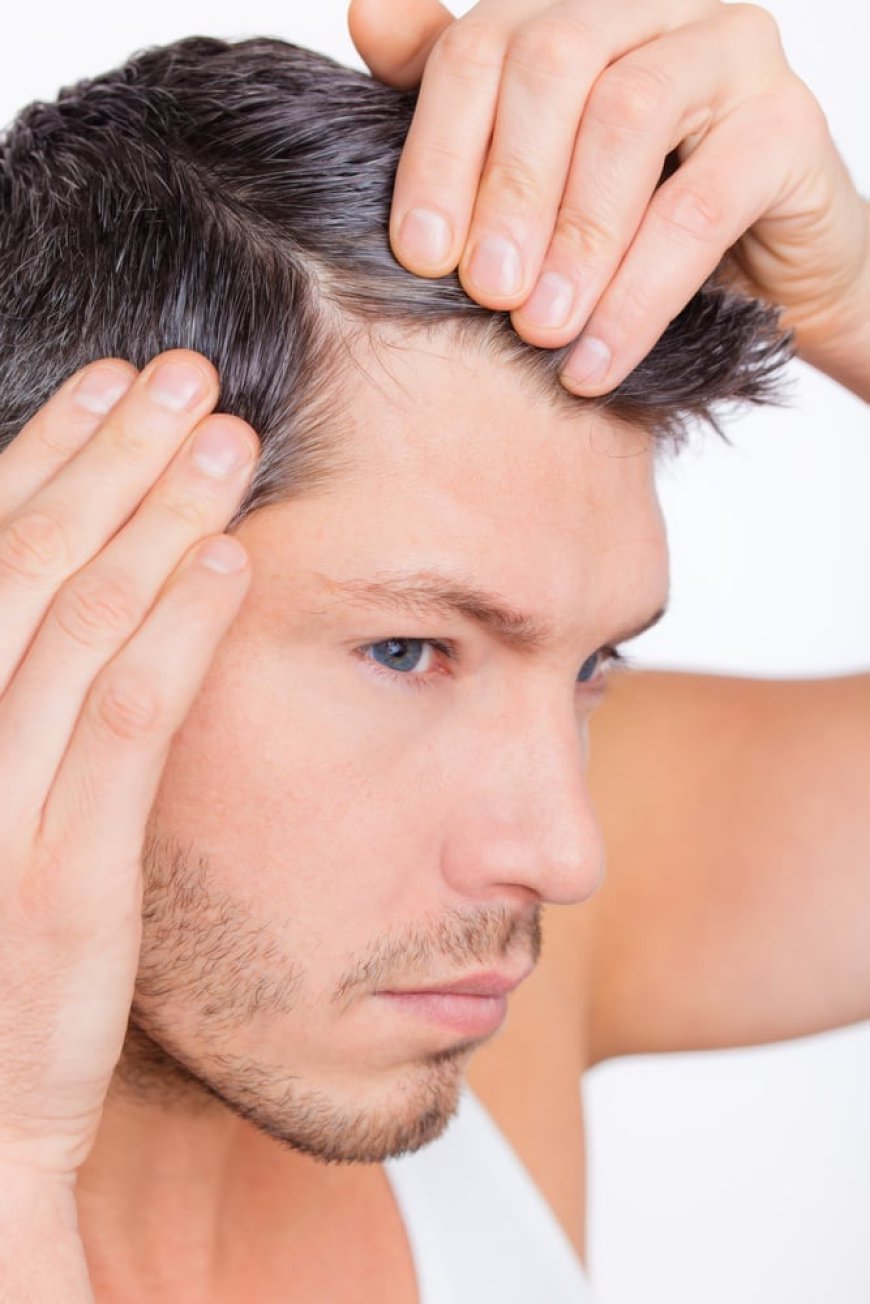 Hair Transplant Cost  Solutions for Every Budget