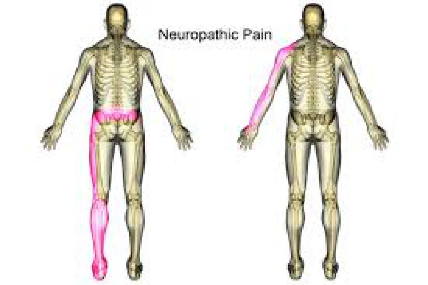 Innovative Approaches to Treating Neuropathic Pain