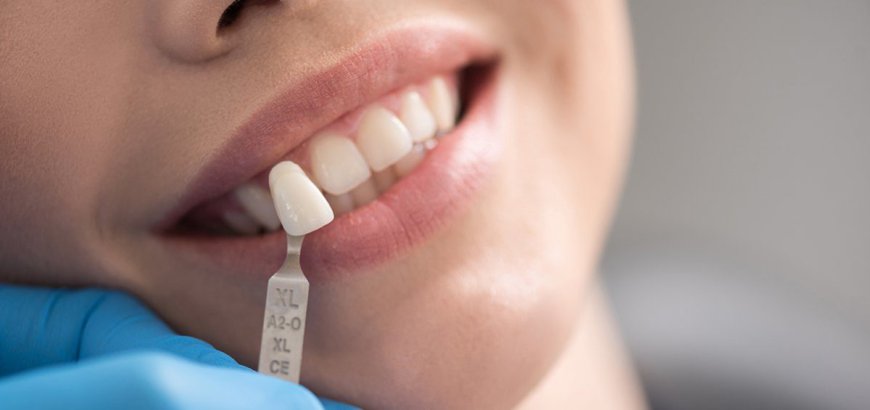 Unlocking the Costs: Dental Fillings in Riyadh Explained