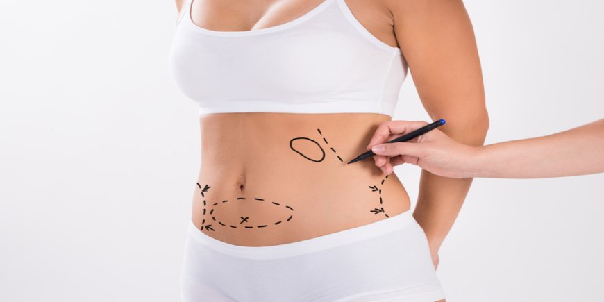 How CoolSculpting in Dubai Addresses Areas of Stubborn Fat