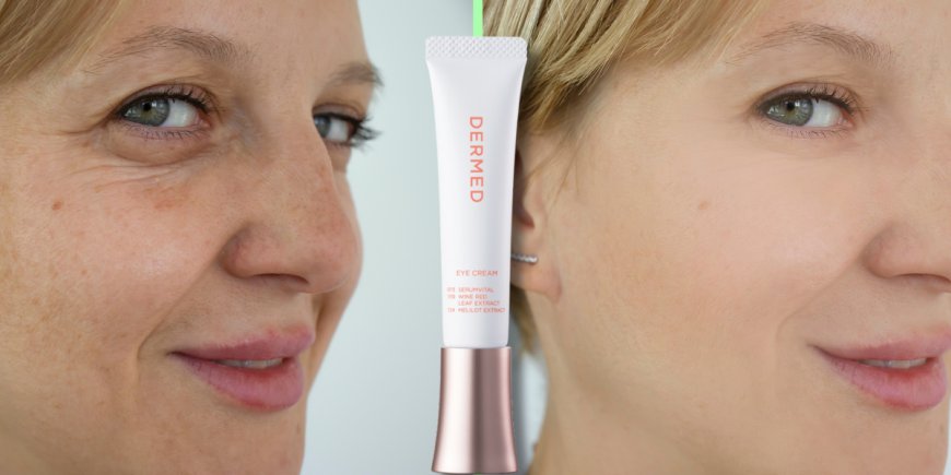 Intensive Care for Eye Wrinkles: Under Eye Cream for a Youthful Look