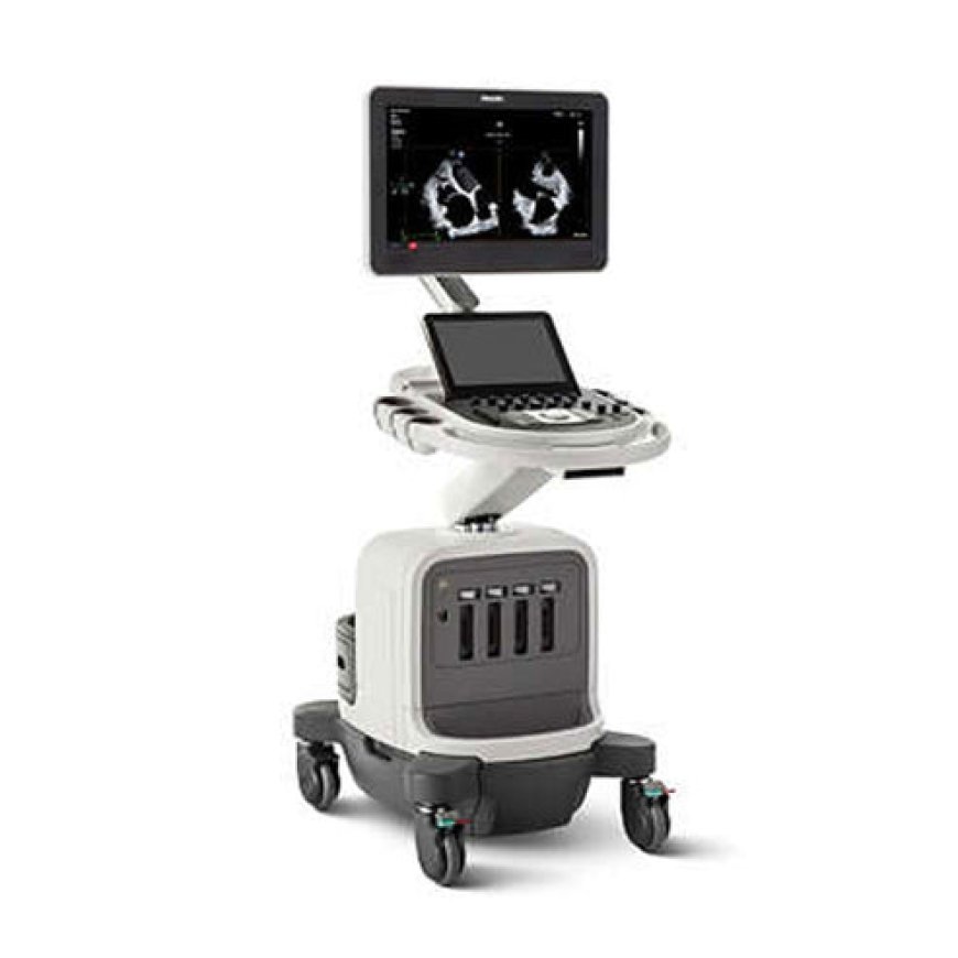 The Benefits of Affiniti CVX: Superior Imaging for Superior Outcomes