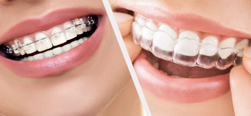 "Expert Tips for Choosing the Perfect Dental Clinic in Riyadh"