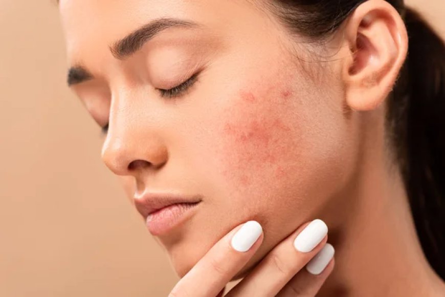 Achieve Radiant Skin with Dubai’s Top Dermatologists