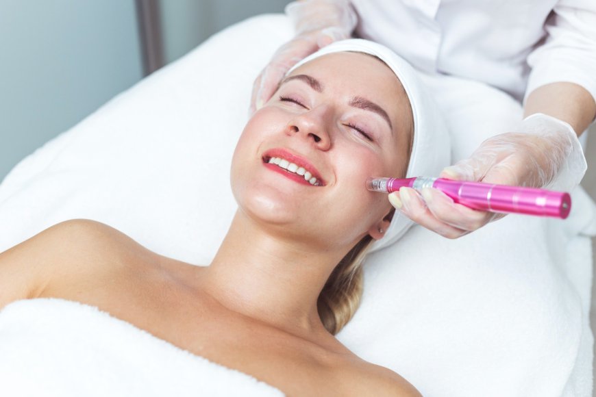 Microneedling: The Non-Surgical Skin Reviver