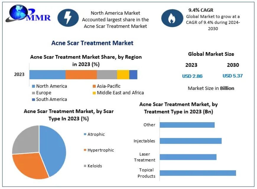 ​​​Acne Scar Treatment Market Trends, Growth Factors, Size, Segmentation and Forecast to 2030