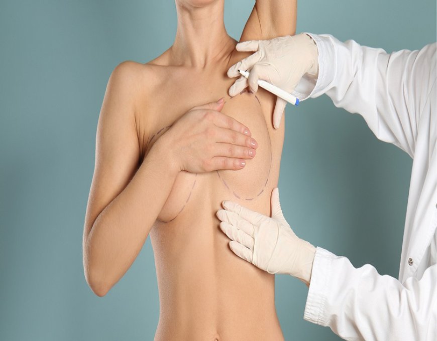 Lift Your Confidence: The Ultimate Guide to Breast Lift in Dubai