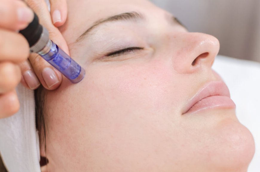 Understanding the Mesotherapy Treatment in Dubai: A Comprehensive Guide