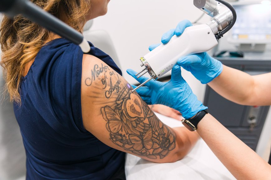 Beautiful Skin Awaits: Laser Tattoo Removal Insights