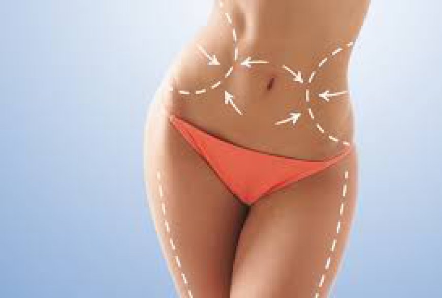 Affordable Liposuction in Riyadh: How to Plan for Surgery Costs