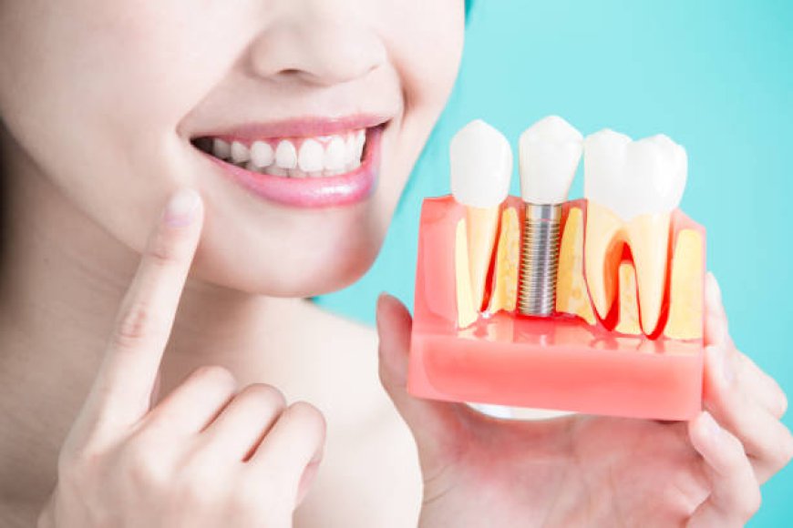 Affordable Dental Implants in Riyadh: Finding Quality Care