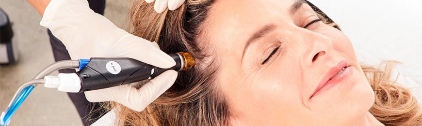 The Secret to Gorgeous Hair: Hydrafacial Scalp Treatment