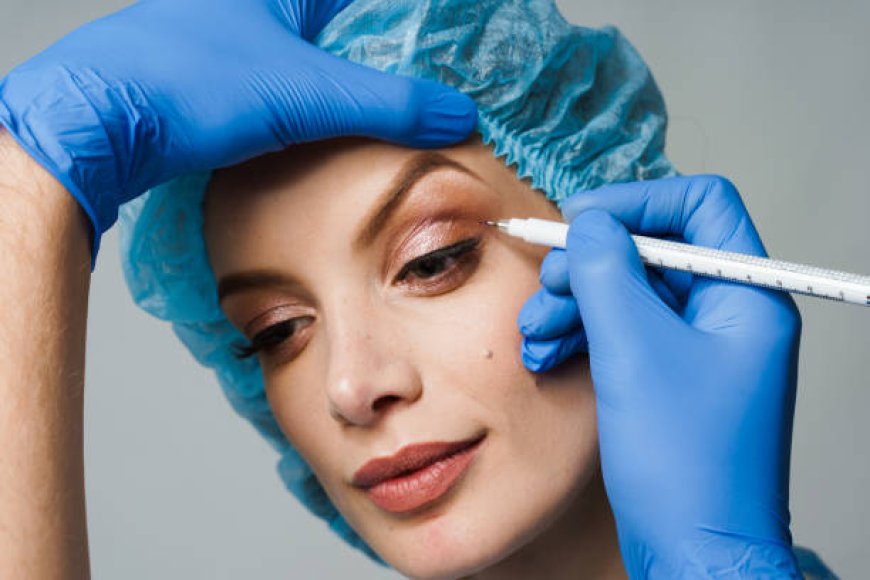 Eyelid Surgery Recovery Tips: What to Expect After Surgery in Riyadh