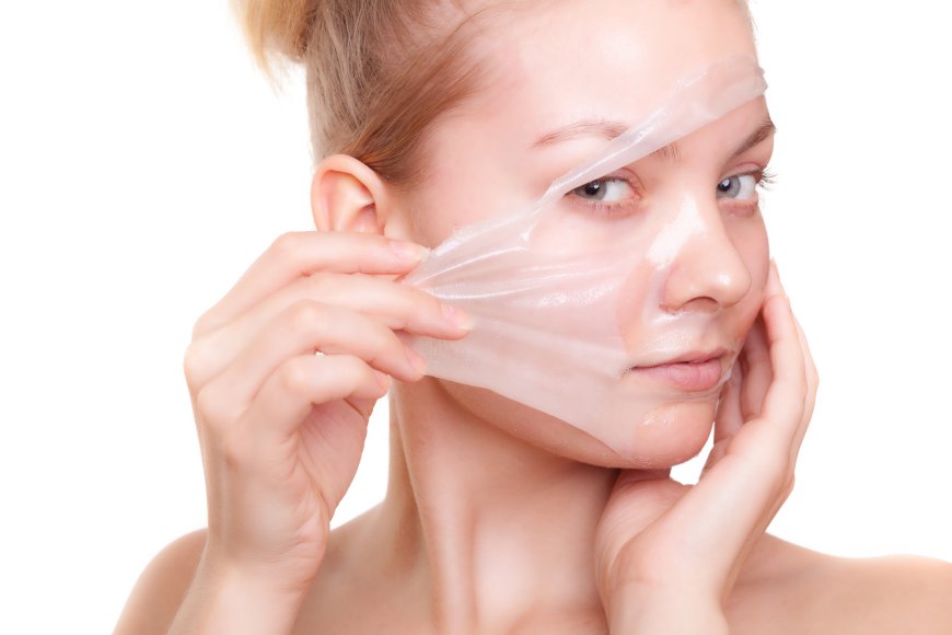 Chemical Peels for Acne Scars in Dubai: Effective Solutions for Clearer Skin