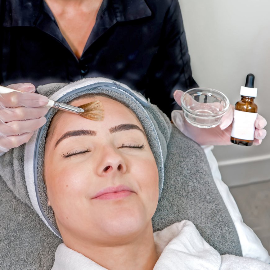 The Top Benefits of Regular Chemical Peels