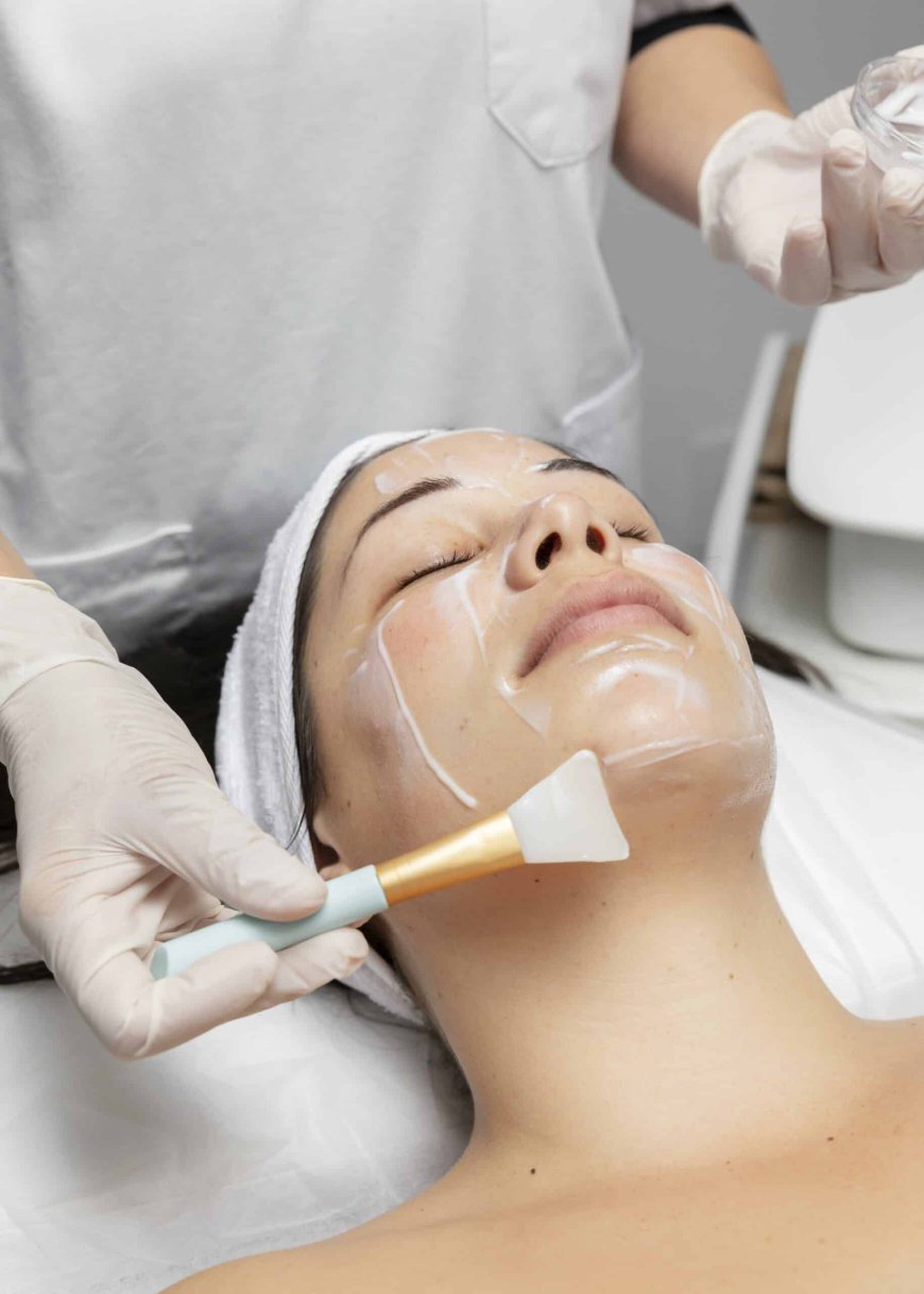 Chemical Peels: Your Go-To Treatment for Glowing Skin