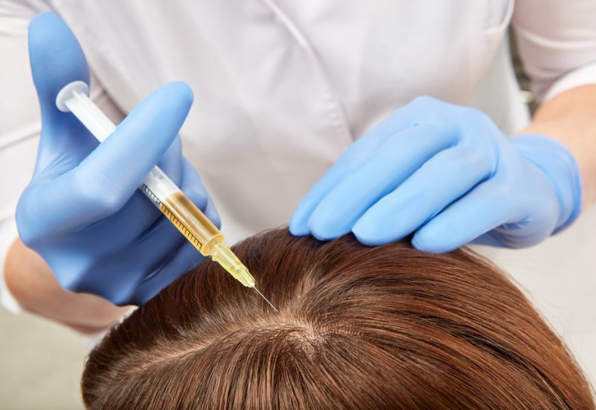 PRP Hair Therapy: Thickening and Strengthening Hair Strands