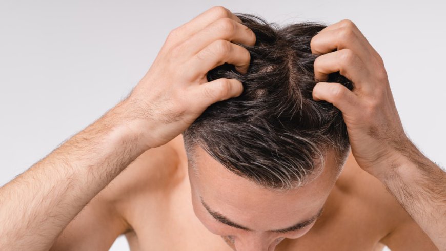 Finasteride for Hair Loss Regrow Your Hair Fast