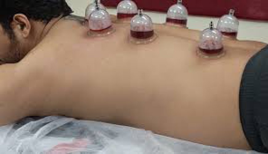 Hijama Therapy Perfect for Pain and Stress