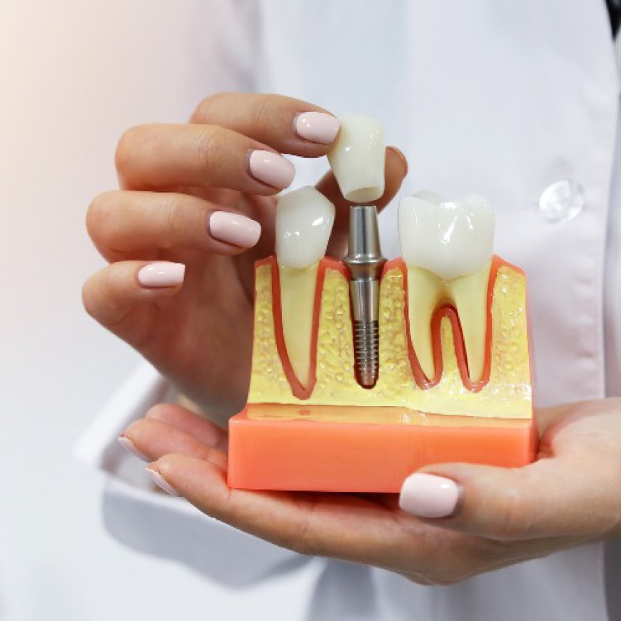 Best Dental Implants in Gurgaon: A Comprehensive Guide to Dental Excellence