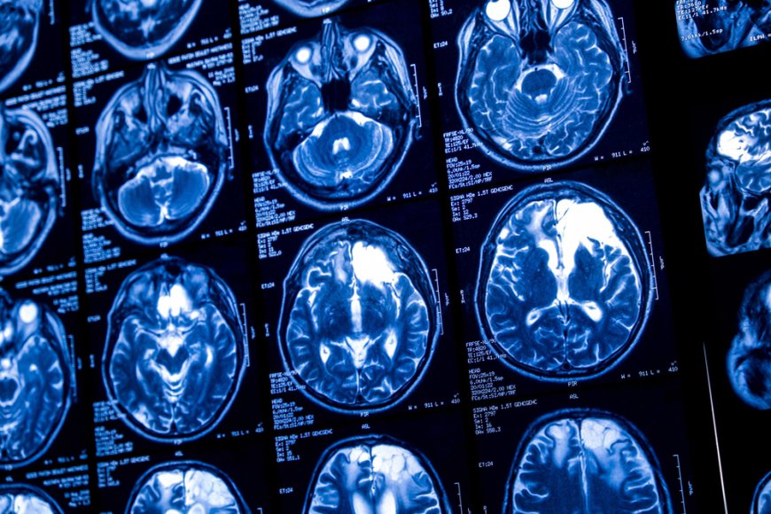 Using Neurological Imaging to Decode Mental Health Disorders