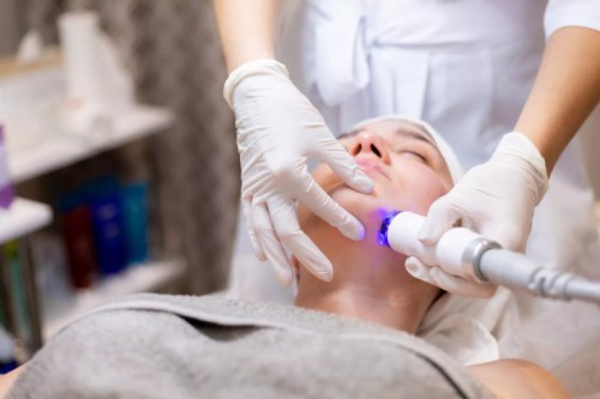 The Advantages of Choosing Fractional RF Microneedling Treatment